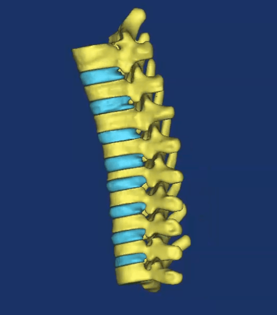 Read more about the article مدلسازی هندسه ستون فقرات ناحیه گردنی به همراه دیسک