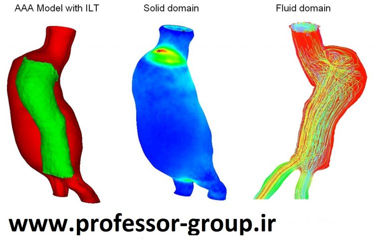 Read more about the article تحلیل FSI در بیومکانیک