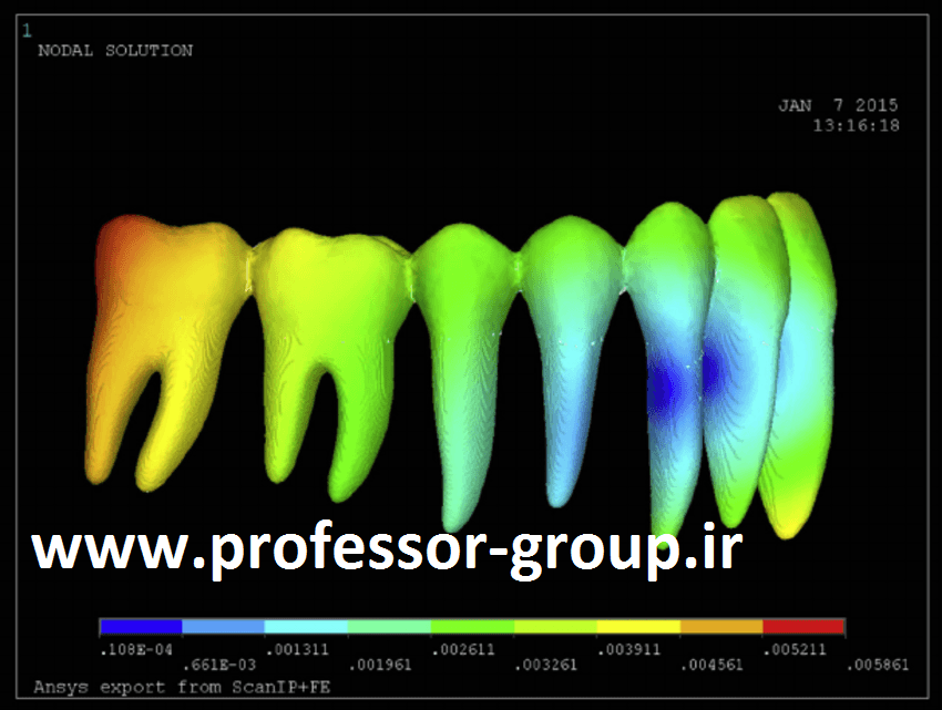 You are currently viewing بررسی توزیع تنش در دندان انسان