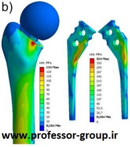 تحلیل استاتیکی و دینامیکی پروتز فمور در آباکوس