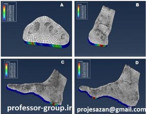 مدل اجزای محدود دو بعدی پا برای gait analysis