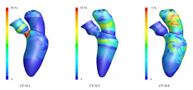 Read more about the article بررسی جریان سمت چپ قلب با مدل سازی حرکت دیواره