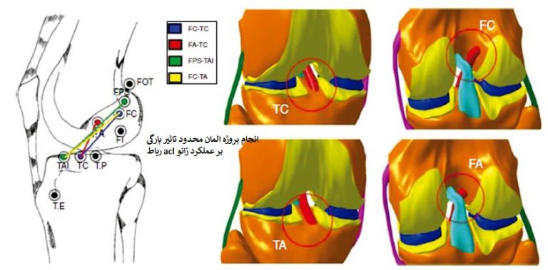 Read more about the article انجام پروژه المان محدود تاثیر پارگی رباط acl بر عملکرد زانو