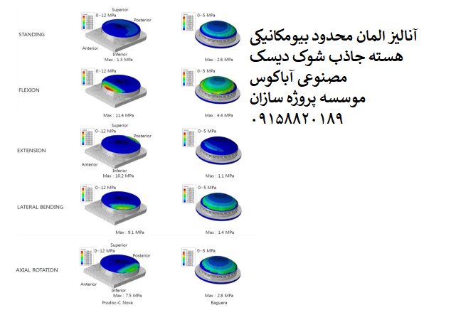 Read more about the article آنالیز المان محدود بیومکانیکی هسته جاذب شوک دیسک مصنوعی آباکوس