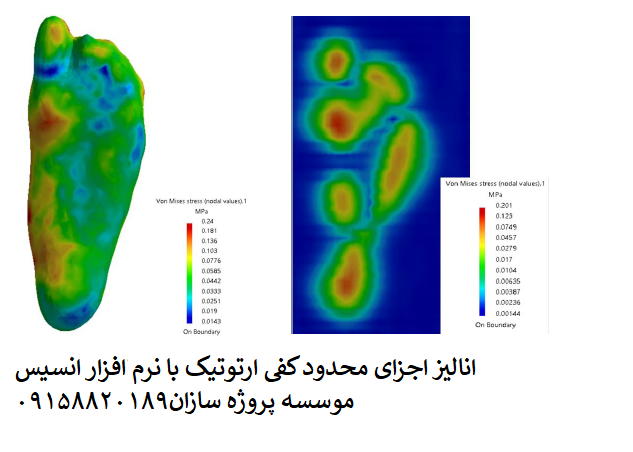 Read more about the article انالیز اجزای محدود کفی ارتوتیک با نرم افزار انسیس