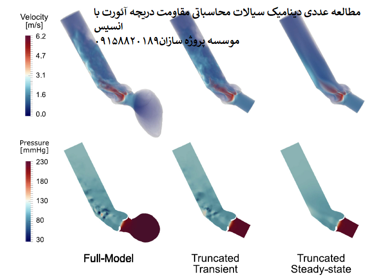 You are currently viewing مطالعه عددی دینامیک سیالات محاسباتی مقاومت دریچه آئورت با انسیس