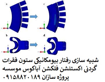 Read more about the article شبیه سازی رفتار بیومکانیکی ستون فقرات گردنی اکستنشن فلکشن آباکوس