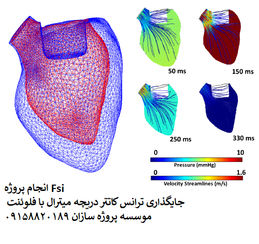 You are currently viewing انجام پروژه Fsi جایگذاری ترانس کاتتر دریچه میترال با فلوئنت