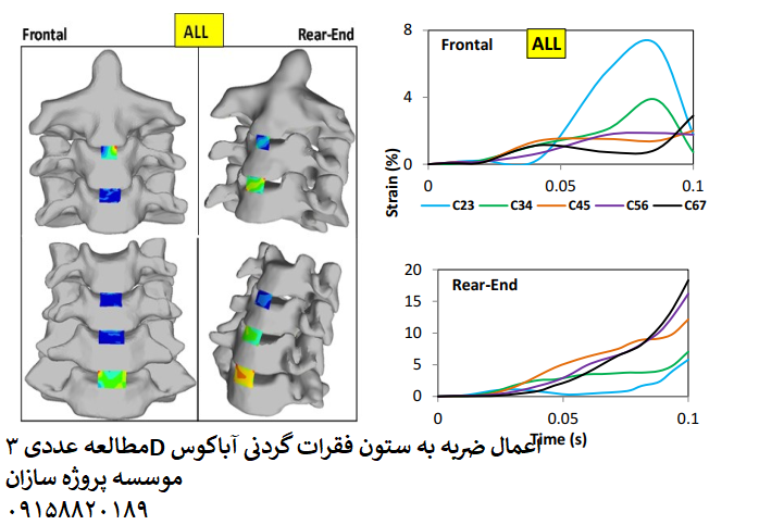 Read more about the article مطالعه عددی ۳D اعمال ضربه به ستون فقرات گردنی آباکوس