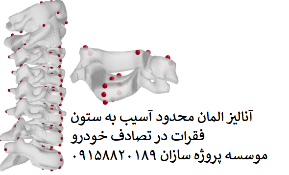 Read more about the article آنالیز المان محدود آسیب به ستون فقرات در تصادف خودرو