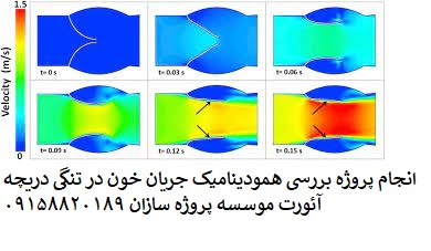 Read more about the article انجام پروژه بررسی همودینامیک جریان خون در تنگی دریچه آئورت