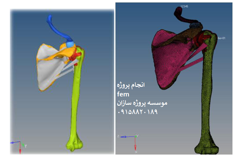Read more about the article آنالیز FEM تنش مفصل شانه و عضلات برای اداکشن ابداکشن