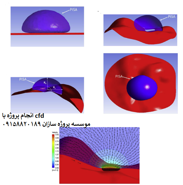 Read more about the article آنالیز cfd اولتراسونیک نارسایی دریچه میترال با ansys