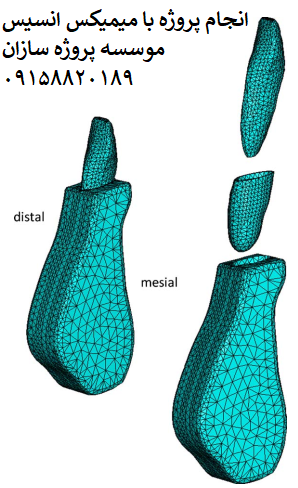 Read more about the article شبیه سازی عددی Fem بازسازی استخوان ارتودنسی میمیکس انسیس