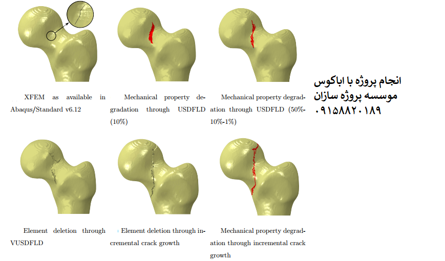 You are currently viewing مدلسازی شکستگی استخوان فمور المان محدود با abaqus