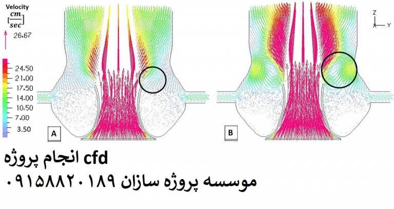 Read more about the article بررسی عددی اثر همودینامیکی دریچه آئورت بر جریان کرونر