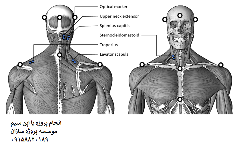 Read more about the article شبیه سازی ستون فقرات گردنی با الکترومیوگرافی در OpenSim