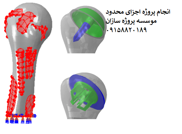 Read more about the article پروژه اجزای محدود استخوان بازو پس از عمل جراحی آرتروپلاستی