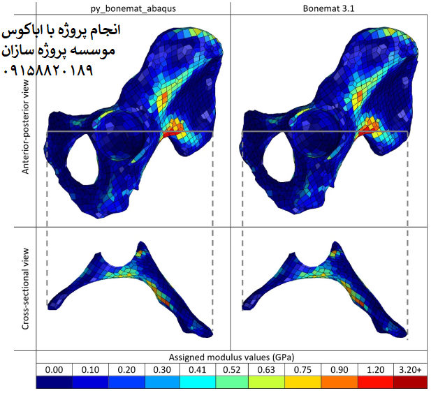 Read more about the article نرم افزار تخصیص خواص مکانیکی استخوان برای مدلسازی اجزای محدود