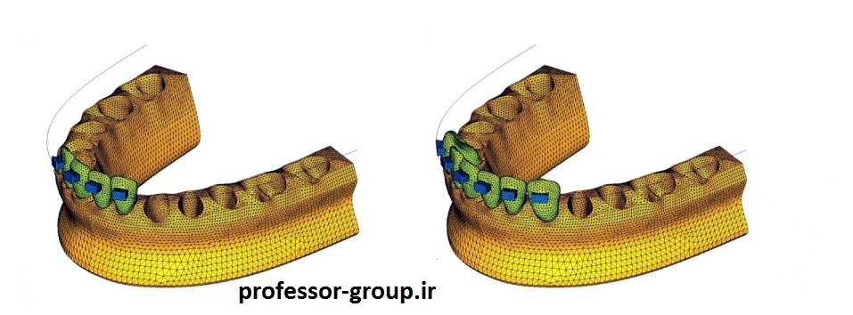 Read more about the article تحلیل المان محدود ارتودنسی