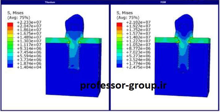 Read more about the article تحلیل المان محدود FGM ایمپلنت دندانی در آباکوس