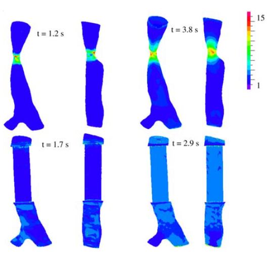 Read more about the article تحلیل CFD ریه انسان در شرایط مرزی امپدانس