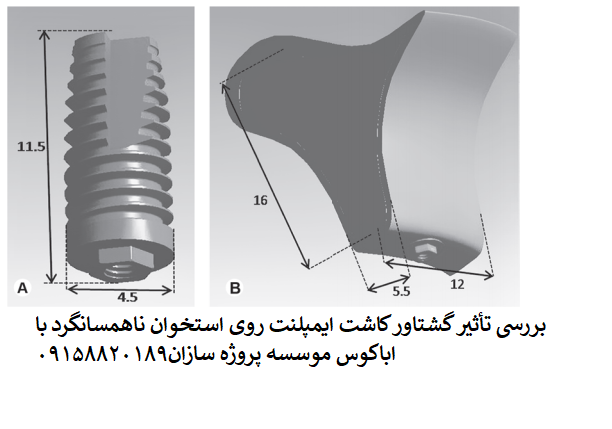 Read more about the article بررسی تأثیر گشتاور کاشت ایمپلنت روی استخوان ناهمسانگرد با اباکوس