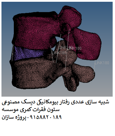 Read more about the article شبیه سازی عددی رفتار بیومکانیکی دیسک مصنوعی ستون فقرات کمری